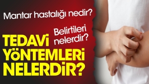 mantar-hastaligi-nedir-belirtileri-nelerdir-tedavi-sistemleri-nelerdir-Ed8QDt3s.jpg