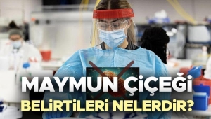 maymun-cicegi-belirtileri-nelerdir-maymun-cicegi-hastaligi-nedir-nasil-anlasilir-birinci-belirtileri-nelerdir-uMSIXt47.jpg