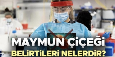 maymun-cicegi-belirtileri-nelerdir-maymun-cicegi-hastaligi-nedir-nasil-anlasilir-birinci-belirtileri-nelerdir-uMSIXt47.jpg