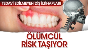 mediastinit-riski-nedir-nerede-gorulur-ziyanlari-nelerdir-wYqtCgIy.jpg