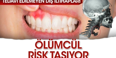 mediastinit-riski-nedir-nerede-gorulur-ziyanlari-nelerdir-wYqtCgIy.jpg