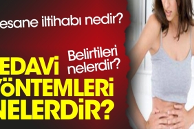 mesane-iltihabi-nedir-belirtileri-nelerdir-tedavi-formulleri-nelerdir-ECV6UlBN.jpg
