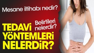 mesane-iltihabi-nedir-belirtileri-nelerdir-tedavi-formulleri-nelerdir-ECV6UlBN.jpg