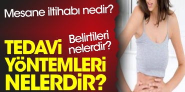 mesane-iltihabi-nedir-belirtileri-nelerdir-tedavi-formulleri-nelerdir-ECV6UlBN.jpg