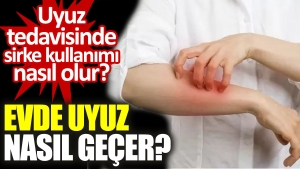 meskende-uyuz-nasil-gecer-uyuz-tedavisinde-sirke-kullanimi-nasil-olur-A91JwE51.jpg