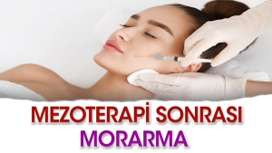 mezoterapi-sonrasi-morarma-nasil-gecer-S41BXf46.jpg