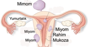 myomlar-wxUA28ZQ.jpg