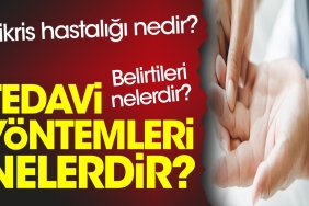 nikris-hastaligi-nedir-belirtileri-nelerdir-tedavi-metotlari-nelerdir-c5rTdR4v.jpg