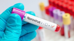 norovirus-enfeksiyonu-nedir-belirtileri-ve-tedavisi-3EIMGQyT.jpg