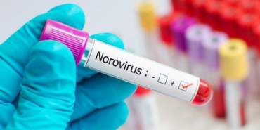 norovirus-enfeksiyonu-nedir-belirtileri-ve-tedavisi-3EIMGQyT.jpg
