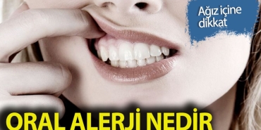 oral-alerji-nedir-7dp75B8m.jpg