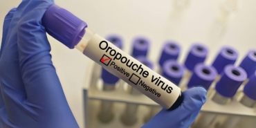 oropouche-virusu-nedir-ve-nasil-tedavi-edilir-UkUt2O4R.jpg