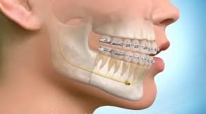 ortodonti-nedir-2j25U8yv.jpg