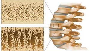 osteoartrit-nedir-nasil-olusur-YfsmYtYV.jpg