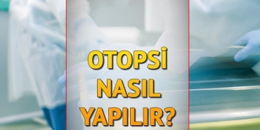 otopsi-nasil-yapilir-kac-saat-surer-otopsi-nedir-ne-demek-rojin-olayi-ile-gundemde-lNyKp6a3.jpg