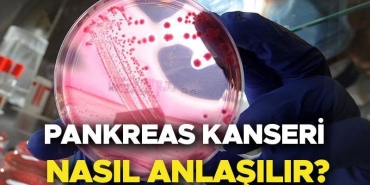 pankreas-kanseri-nedir-belirtileri-nelerdir-survivor-hasanin-hastaligi-pankreas-kanseri-nasil-anlasilir-neden-olur-YiRIy7VG.jpg