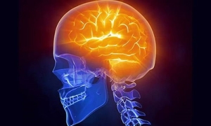 parkinsonizm-nedir-1k54zRh7.jpg