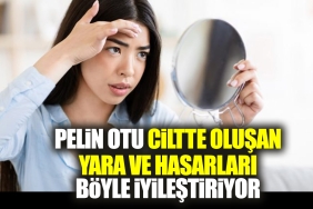 pelin-otu-ciltte-olusan-yara-ve-hasarlari-bu-turlu-duzgunlestiriyor-g7uK77Nw.jpg