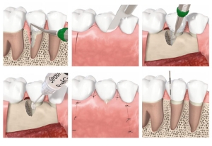 periodontoloji-nedir-hedefleri-nelerdir-XwJXKKSv.jpg