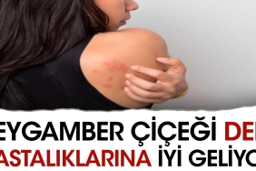 peygamber-cicegi-deri-hastaliklarina-uygun-geliyor-cUcju3mL.jpg