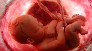 prenatal-genetik-teshis-testleri-4c11QJDr.jpg