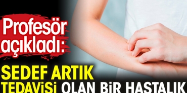 profesor-acikladi-sedef-artik-tedavisi-olan-bir-hastalik-7GafX6xh.jpg