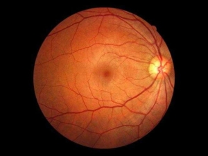 retina-dekolmani-nedir-J7nZ9b7f.jpg