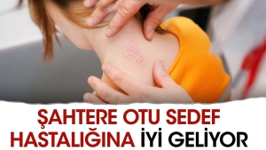 sahtere-otu-sedef-hastaligina-uygun-geliyor-z3f9WTWv.jpg