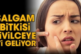 salgam-bitkisi-sivilceye-uygun-geliyor-nGY66BqQ.jpg