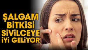 salgam-bitkisi-sivilceye-uygun-geliyor-nGY66BqQ.jpg