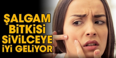 salgam-bitkisi-sivilceye-uygun-geliyor-nGY66BqQ.jpg