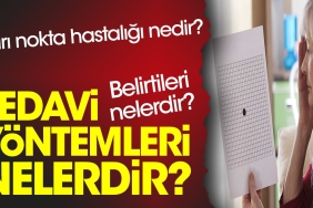 sari-nokta-hastaligi-nedir-belirtileri-nelerdir-tedavi-metotlari-nelerdir-q1VBEeC6.jpg