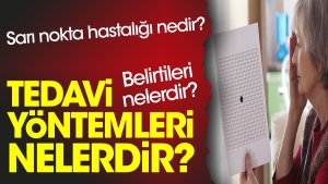 sari-nokta-hastaligi-nedir-belirtileri-nelerdir-tedavi-metotlari-nelerdir-q1VBEeC6.jpg
