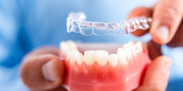 seffaf-plaklar-ile-ortodontik-tedavi-nedir-cBYBg3W1.jpg