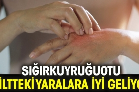 sigirkuyrugu-otu-ciltteki-yaralara-yeterli-geliyor-VSakiwqW.jpg