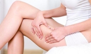 siskinligin-ardindaki-b-tin-tehdit-lipodem-nedir-belirtileri-nelerdir-aTdlJwQr.jpg