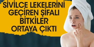 sivilce-lekelerini-geciren-sifali-bitkiler-ortaya-cikti-zJi1ksnj.jpg