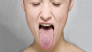 sjogren-sendromu-nedir-belirtileri-nelerdir-sjogren-sendromu-tedavisi-var-mi-Wmw7Zsmc.jpg