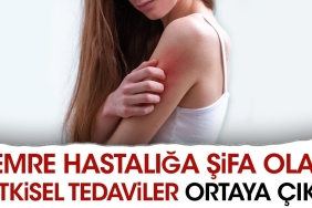 temre-hastaliga-sifa-olan-bitkisel-tedaviler-ortaya-cikti-lLHjhbZ5.jpg
