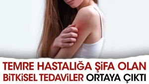 temre-hastaliga-sifa-olan-bitkisel-tedaviler-ortaya-cikti-lLHjhbZ5.jpg