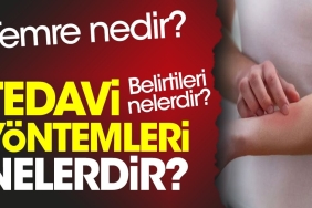 temre-nedir-temre-belirtileri-nelerdir-temre-tedavi-prosedurleri-nelerdir-YcNCNXU6.jpg