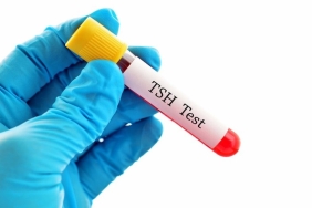 tsh-nedir-kan-testinde-tsh-referans-bedeli-kac-olmalidir-T9fAjY2n.jpg