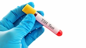 tsh-nedir-kan-testinde-tsh-referans-bedeli-kac-olmalidir-T9fAjY2n.jpg
