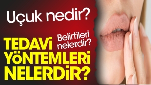 ucuk-nedir-ucuk-belirtileri-nelerdir-ucuk-tedavi-sistemleri-nelerdir-B4s16Yud.jpg