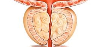 uygun-huylu-prostat-buyumesi-nedir-GYKRBYFT.jpg