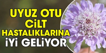 uyuz-otu-cilt-hastaliklarina-yeterli-geliyor-ZPBfI1tC.jpg