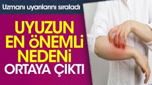 uyuzun-en-kiymetli-nedeni-ortaya-cikti-uzmani-ikazlarini-siraladi-AFcBUQel.jpg