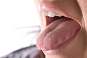 uzmani-acikladi-lisan-kanseri-nedir-belirtileri-nelerdir-E5FZXcH4.jpg