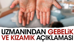 uzmanindan-gebelik-ve-kizamik-aciklamasi-pTDxv8C4.jpg