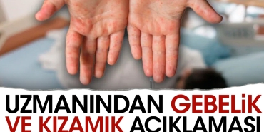 uzmanindan-gebelik-ve-kizamik-aciklamasi-pTDxv8C4.jpg
